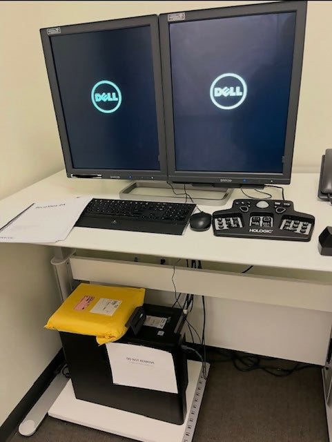 HOLOGIC SecurView DX/RT Workstation