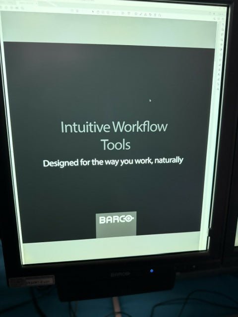 HOLOGIC SecurView DX/RT Workstation