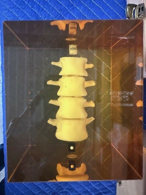 Spine phantom 2